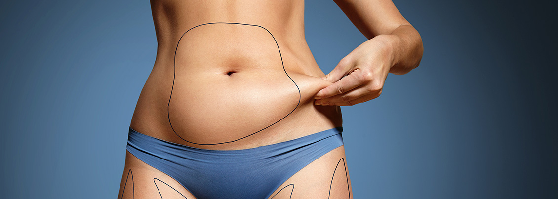 Liposuction Clinic in UAE